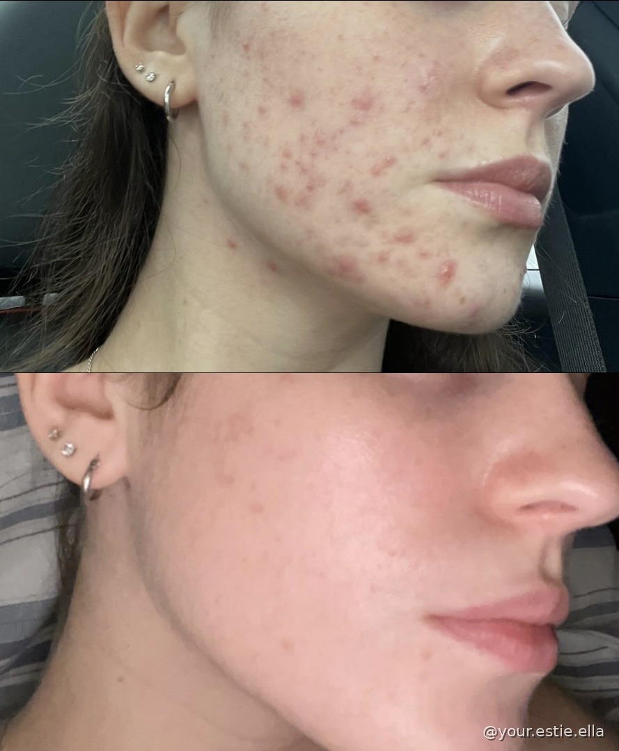 Client before and after