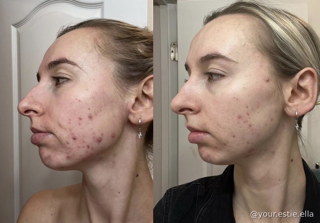 Client before and after